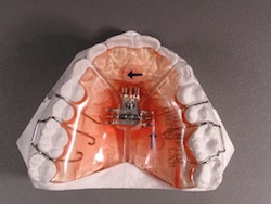 Functional Orthodontics/Orthopedics  Creating Beautiful Faces And Smiles