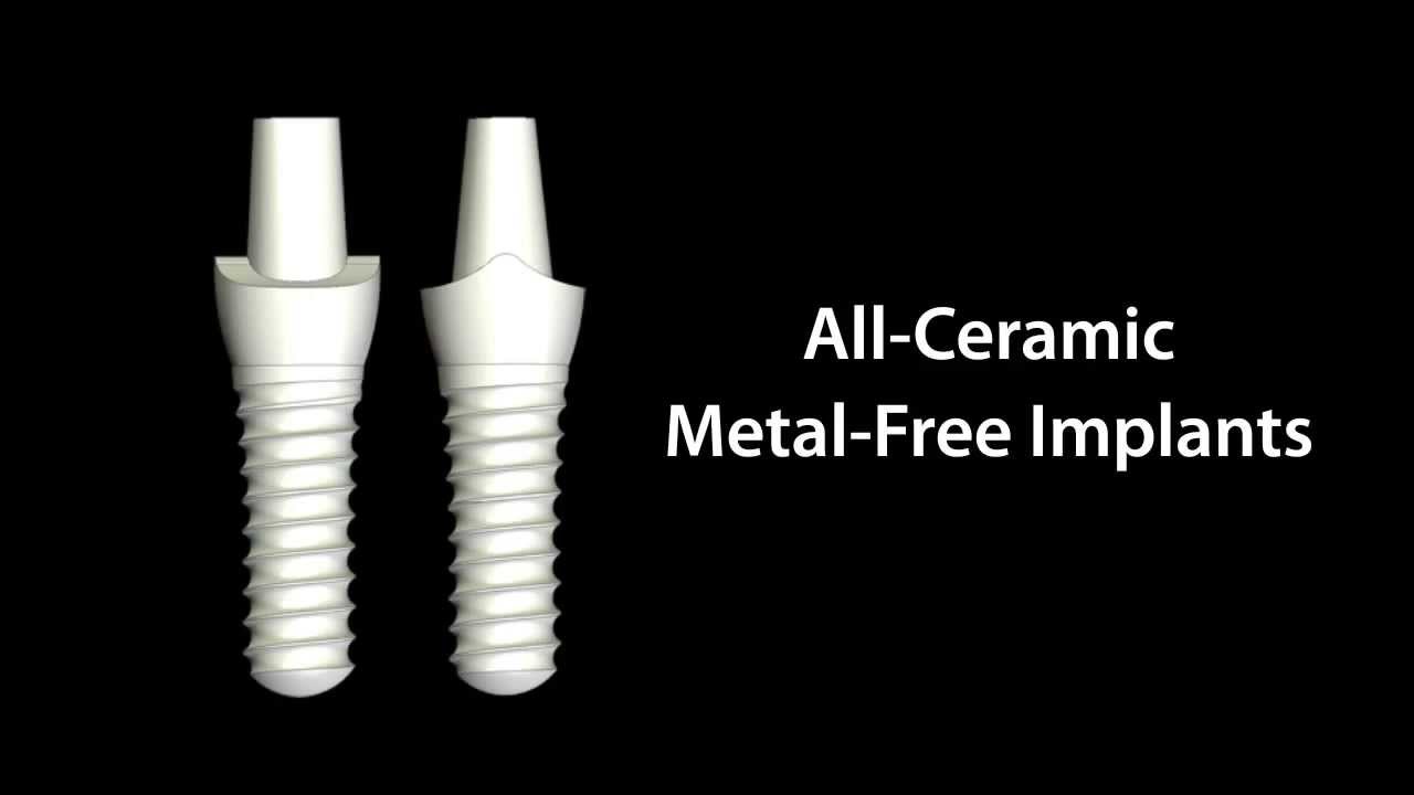 Metal-Free Zirconia Implants – All Ceramic Implants