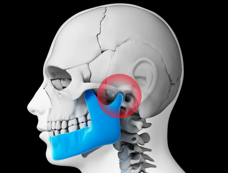 TMJ/TMD Disorders